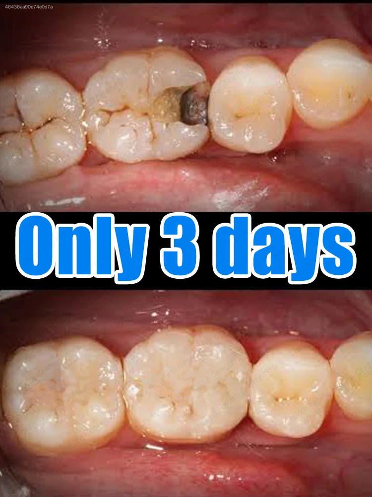 This toothpaste will be your best choice; it's easy to use and highly effective.