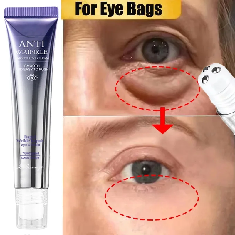 

O'CHEAL Eye Bag Removal Cream Retinol Anti-Wrinkle Firming Skin Fade Fine Lines Anti Dark Circle Puffiness Brighten Eye Care