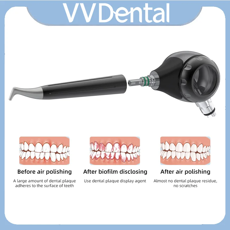 

VVDental Air Prophy Spray Jet Air Polisher Cleanning Tooth Whitening Sandblasting Gun For Supragingival Sandblasting 2/4 Holes