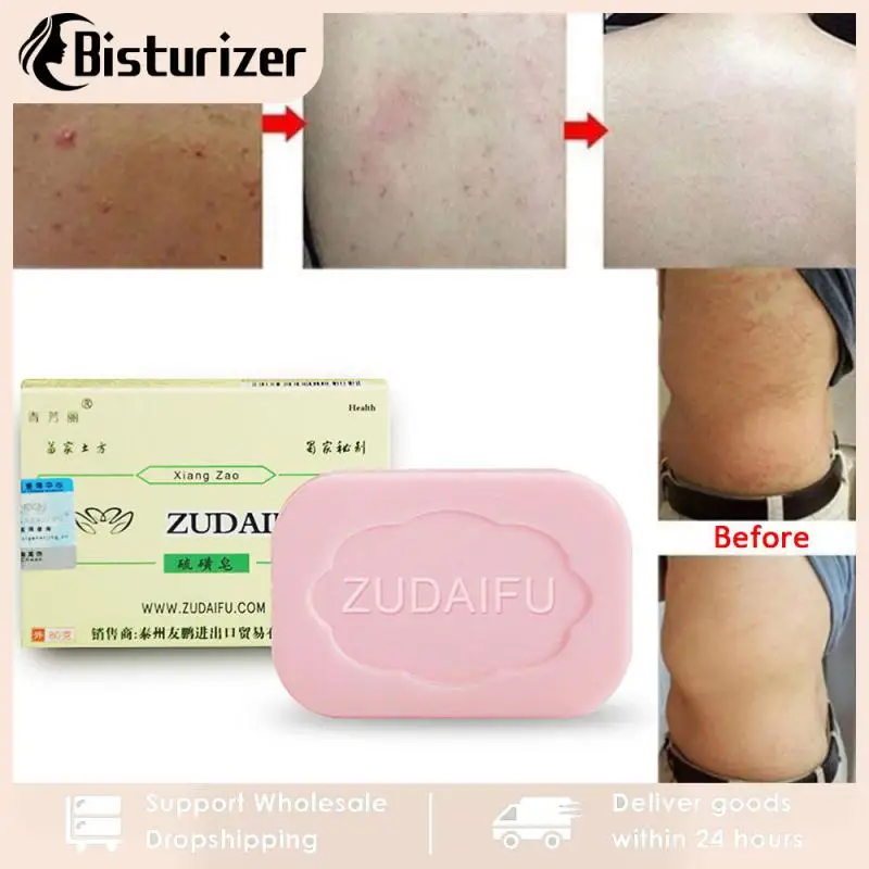 Zudaifu Sulfur Soap Cleanser Oil-Control Cure Face Whitening Sulfur Soap Skin Peel Cleanser Handmade Soap