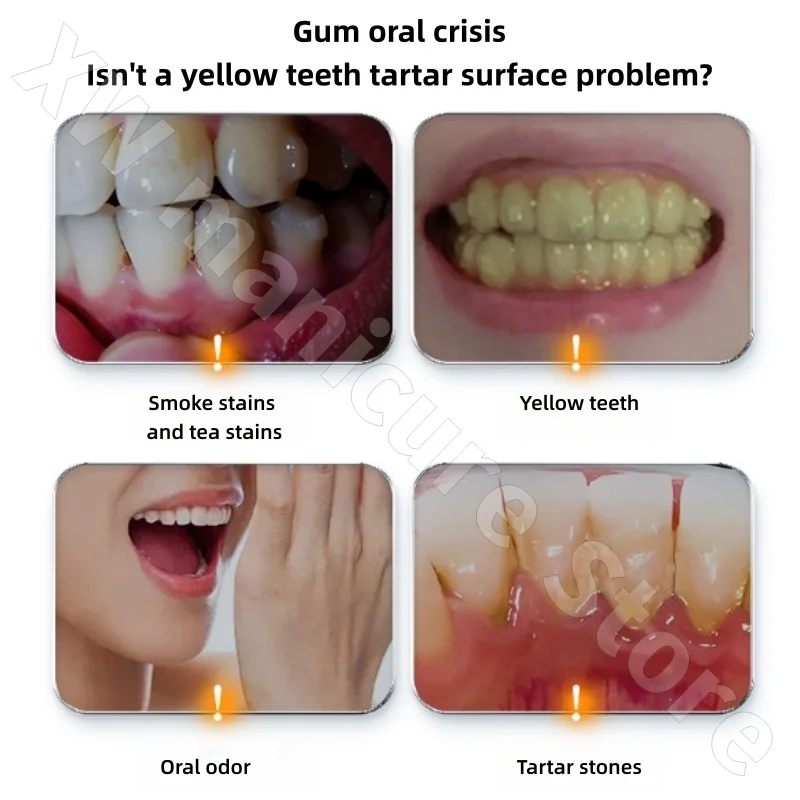 معجون أسنان BOP ببتيد مضاد للبكتيريا وإزالة البقع وتذويب البقع ونغمة إصلاح الطازجة والأصفر 100 جرام #2