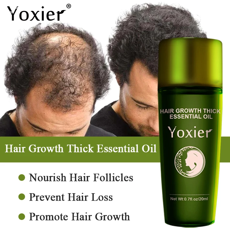 

Hair Growth Products Fast Growing Hair Essential Oil Natural Anti Hair Loss Prevent Hair Dry Frizzy Damaged Repair Care 20ml