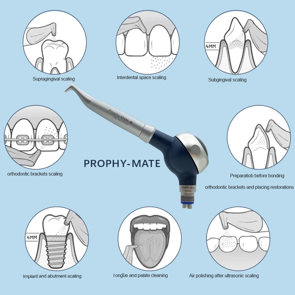 Dental Prophy Air Jet Flow polerka polerowanie zębów pasuje do NSK Prophy-Mate Neo higiena jamy ustnej polerka narzędzie stomatologiczne