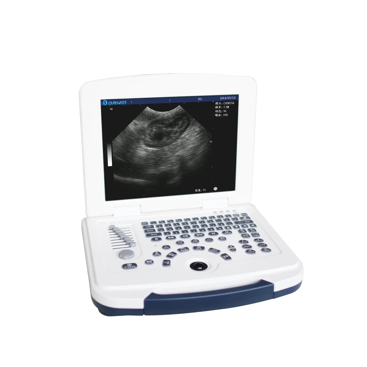 Vet Ultrasound Veterinary Ultrasound Portable Color Doppler Mindray Ultrasound Vet Machine