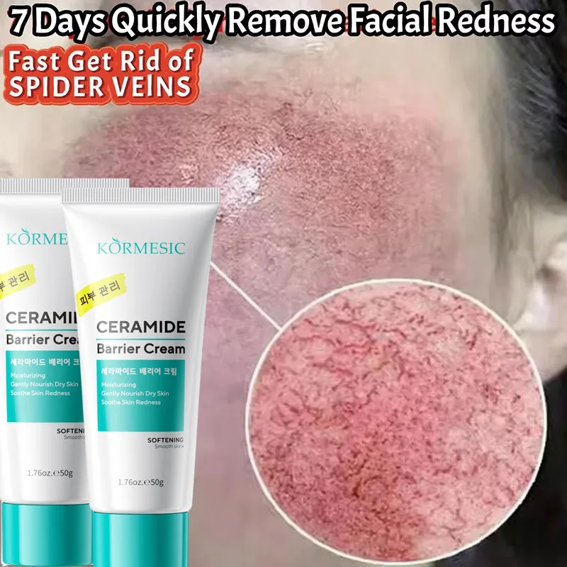 Creme zur Reduzierung von Gesichtsrötungen Verbessert empfindliche Haut Trockenheit Feuchtigkeitsspendende Lotion Rosacea-Reduzierung Koreanische Kosmetik