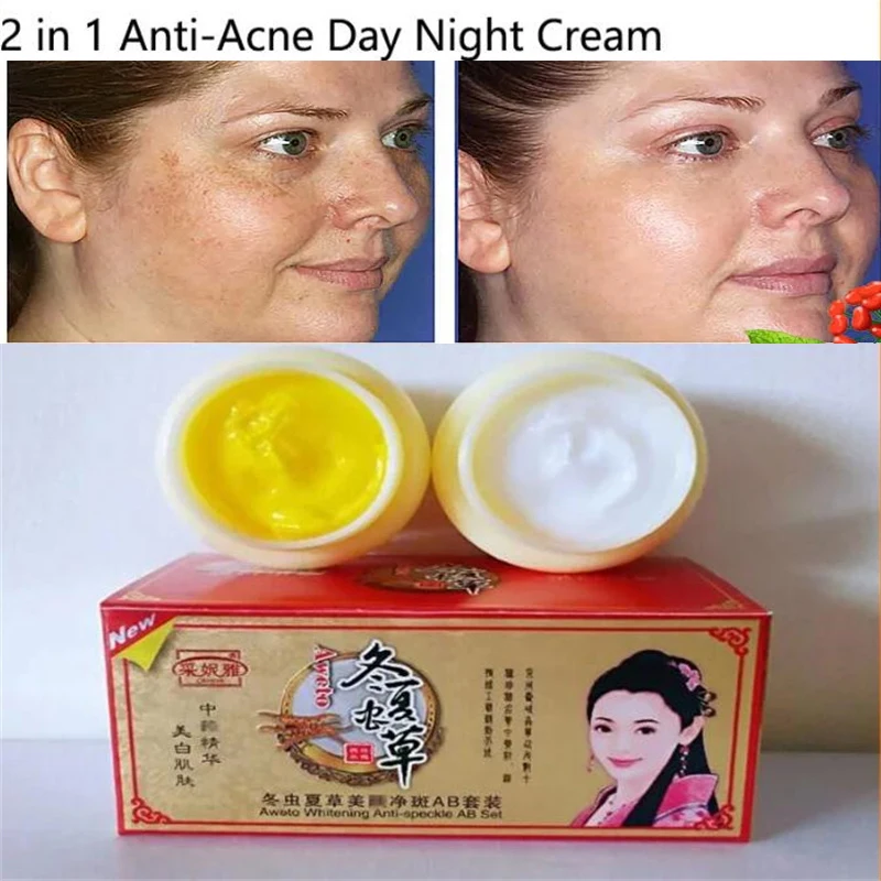 

Chinese Aweto Whitening Anti-Acne Day Night Cream Set Melasma Dark Age Dark Spots Freckle Remover Skin Lightening Skin Care