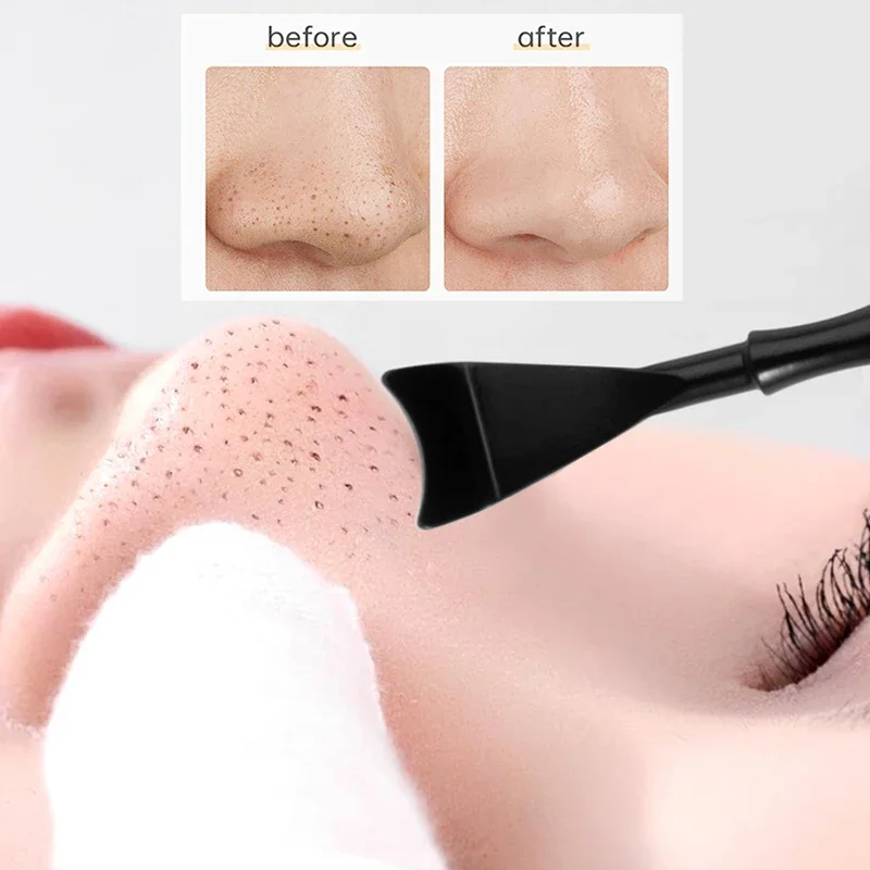 2 In 1 Puistje Popper Tool Comedondrukker Acne Naald Verwijderen Behandeling Whitehead Popping Zit Neus Gezicht Smet Extractor