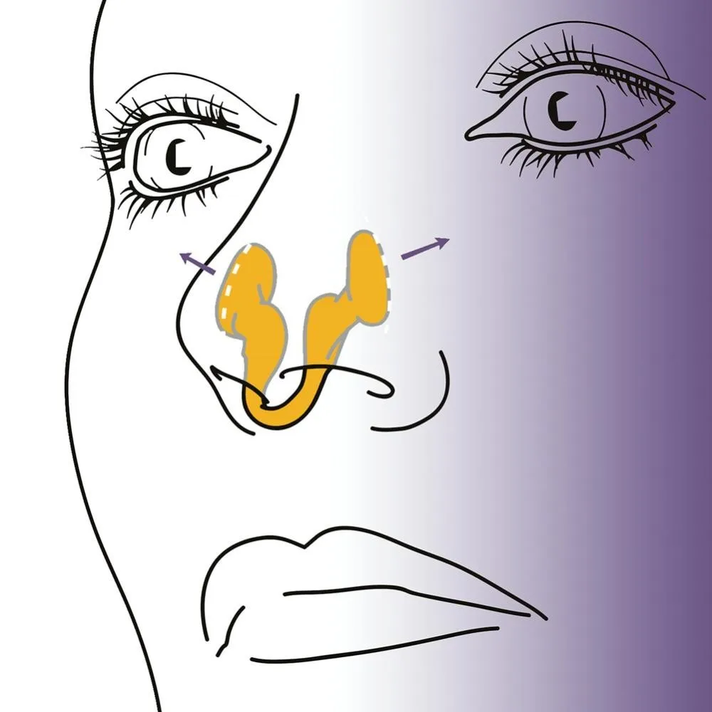 Pince anti-ronflement en silicone, 1 pièce, dilatateur nasal, aide au ronflement, ories facile, améliore la rhinite au sommeil