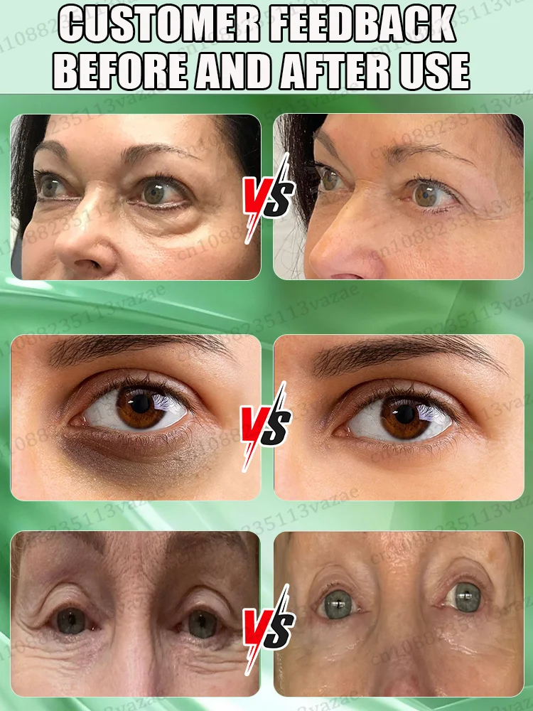 2025 Najlepiej sprzedające się produkty, które sprawią, że optycznie optycznie o 20 lat młodszy