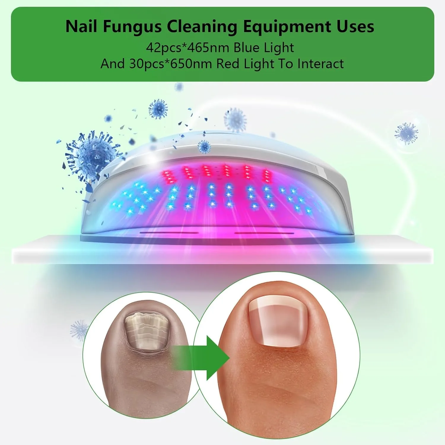 Nail Fungus Laser Device Wireless 465nm Blue Light 650nm Red Light Toenails Nails Onychomycosis Therapy Care Anti Fungal