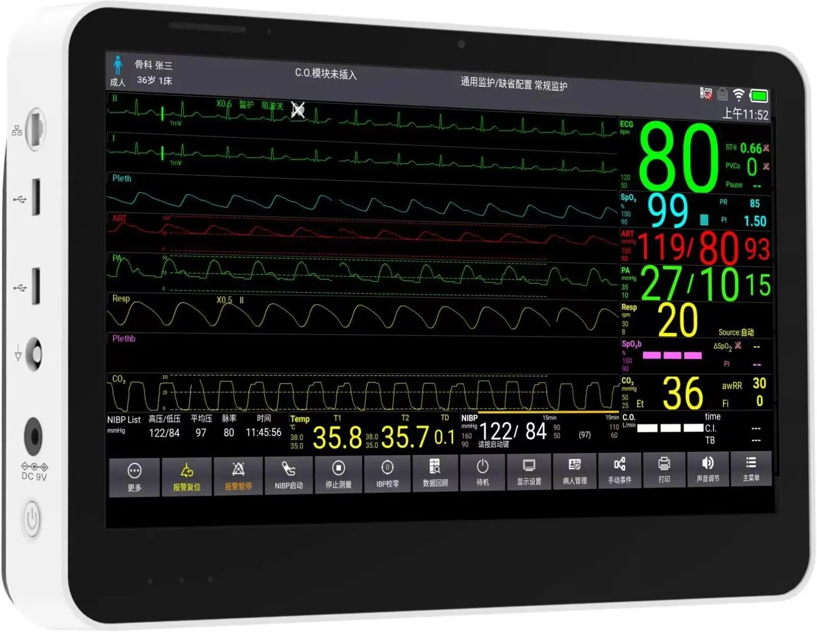 CONTEC CMS8500 Paitnet Monitor Touch 14 Inch Vital Signs Monitor 6 Parameters+ETCO2(Optional）