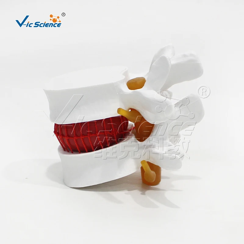 Medical Science Modelo bloqueio lombar, Espinha Humana