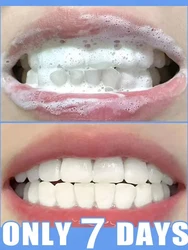 Dentifricio in mousse sbiancante per i denti