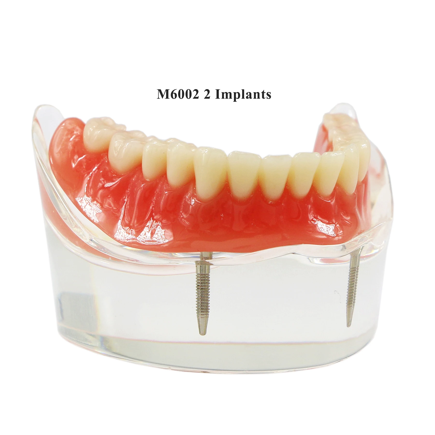 

Стоматологическая модель M6002 Overdenture, низкие импланты, 2 имплантата, основа для исследования, позволяет просматривать импланты