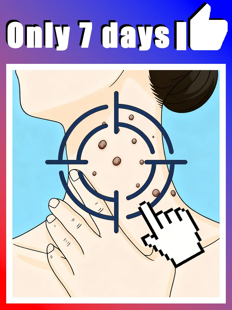 

2025 Hotsale for warts,Make your life less troublesome for warts Body tools,free shipping