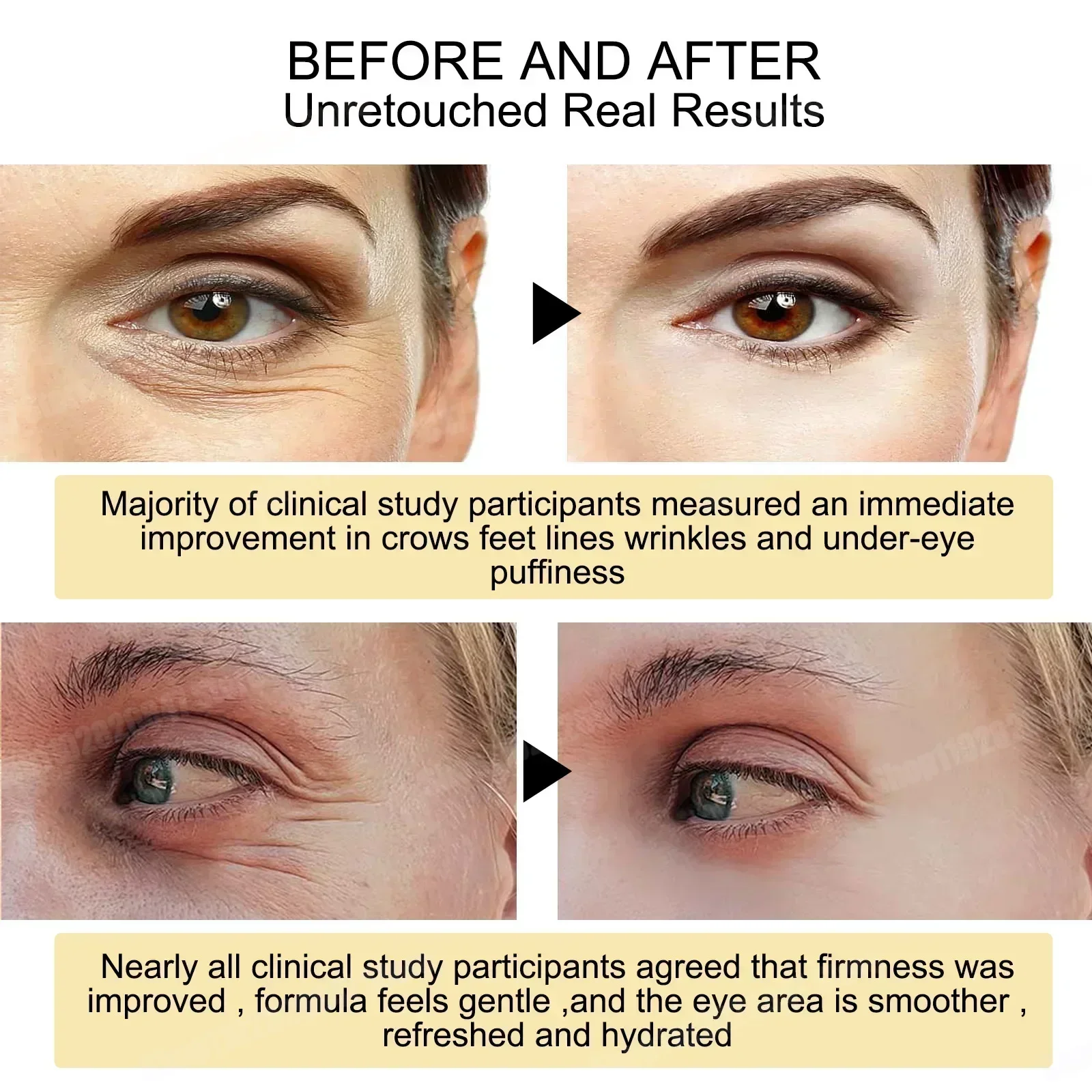 Instant Eye Bag Removal ครีมคอลลาเจน Anti-Wrinkle Fade Fine Lines กระชับผิว Anti Dark Circle Puffiness Brighten Eye Care