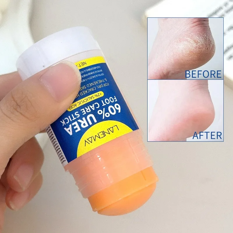 水分補給保湿フットクリーム乾燥ひび割れかかとひび割れ防止足保護クリーム皮膚修復インテンシブハイドラカルスリムーバー40g