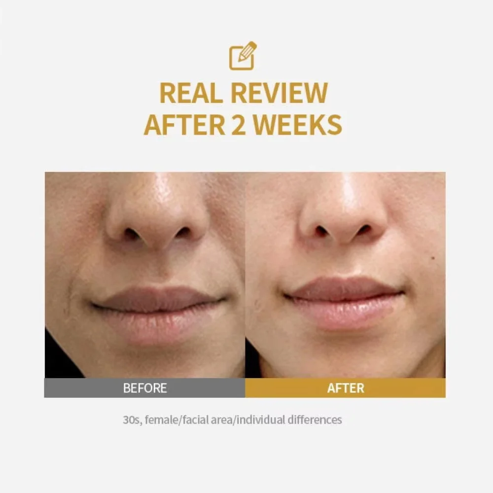 Peptide Intensive Lifting Ampoule, Face Firming Serum