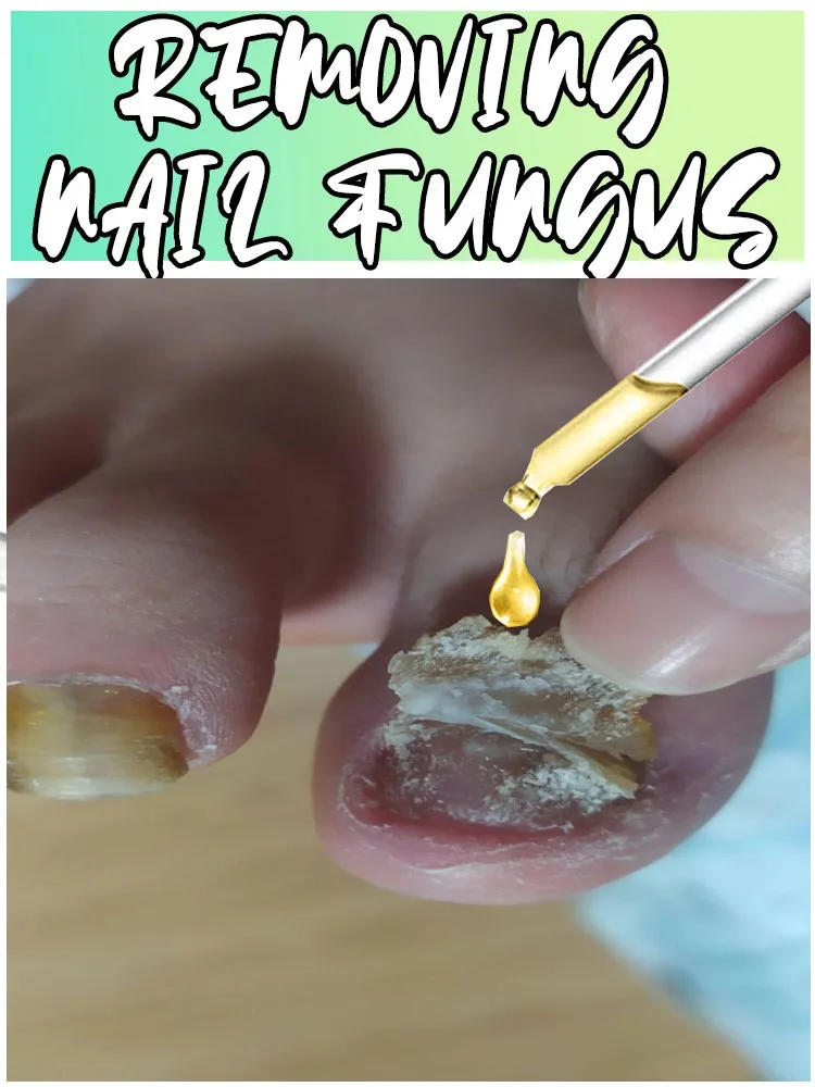 

Hot Sale Toenail Fungus Tools Cleaning Nail Repair Pedicure Manicureed Gray Package Tools