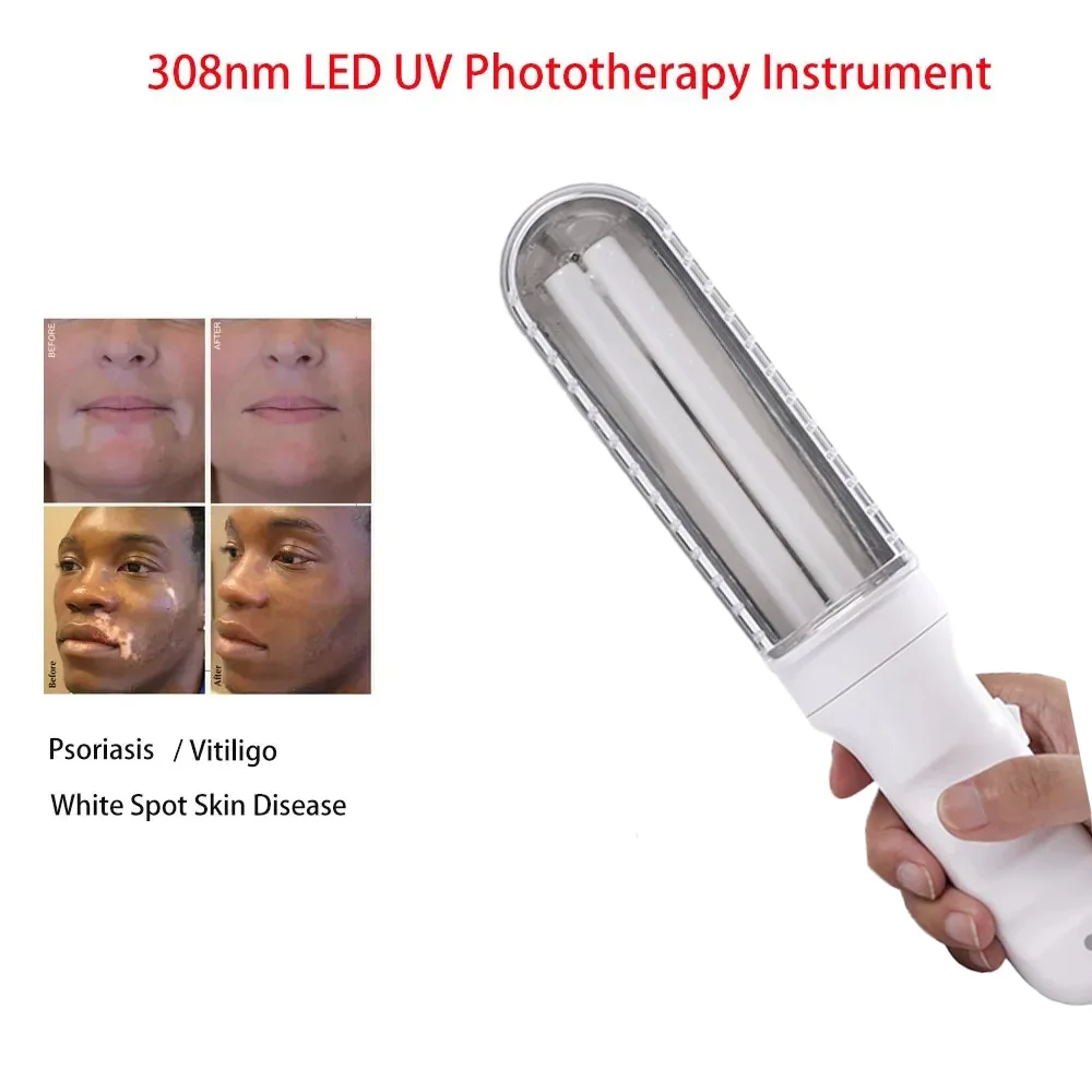 

Uvb Lamp Physical Therapy Equipment Narrowband Phototherapy Lamps Medical Light Source UV Led 308nm Uvb Vitiligo