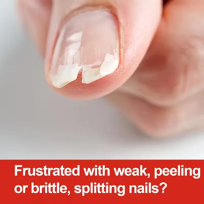 24K Cuticle Essential Oil 30ml Deep Nourishing Nail Care Dry Cracked Heel Toenail Enhancement Nail Strength Smooth Nail Care Oil