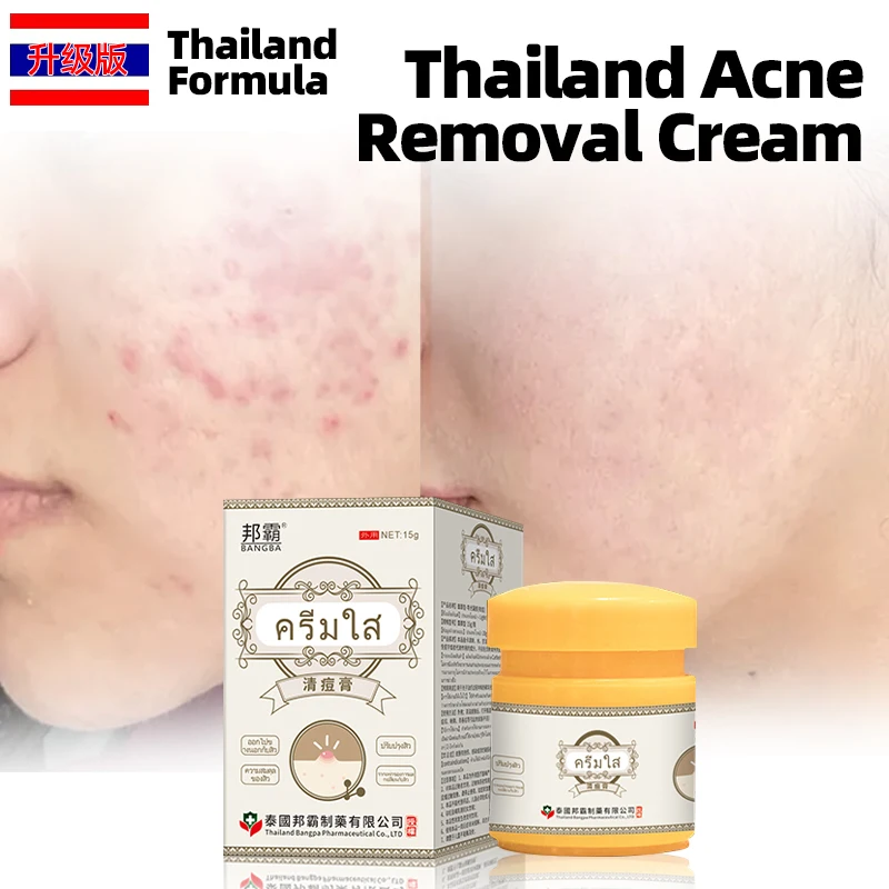 

Acne Treatment Cream Anti Acne Marks Removal Ointment Shrink Pores Blackhead Pimple Remover Whitening Face Care Thailand Formula