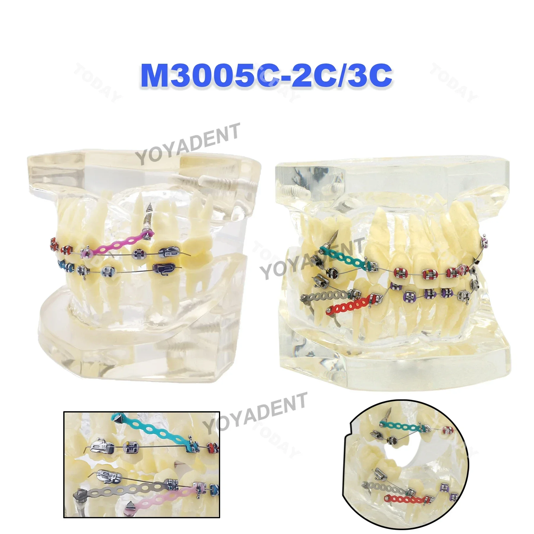 Dental Orthodontic Teeth Model With Hawley Retainer Metal/ Ceramic Brackets Teaching Models For Dentist Patient Communication