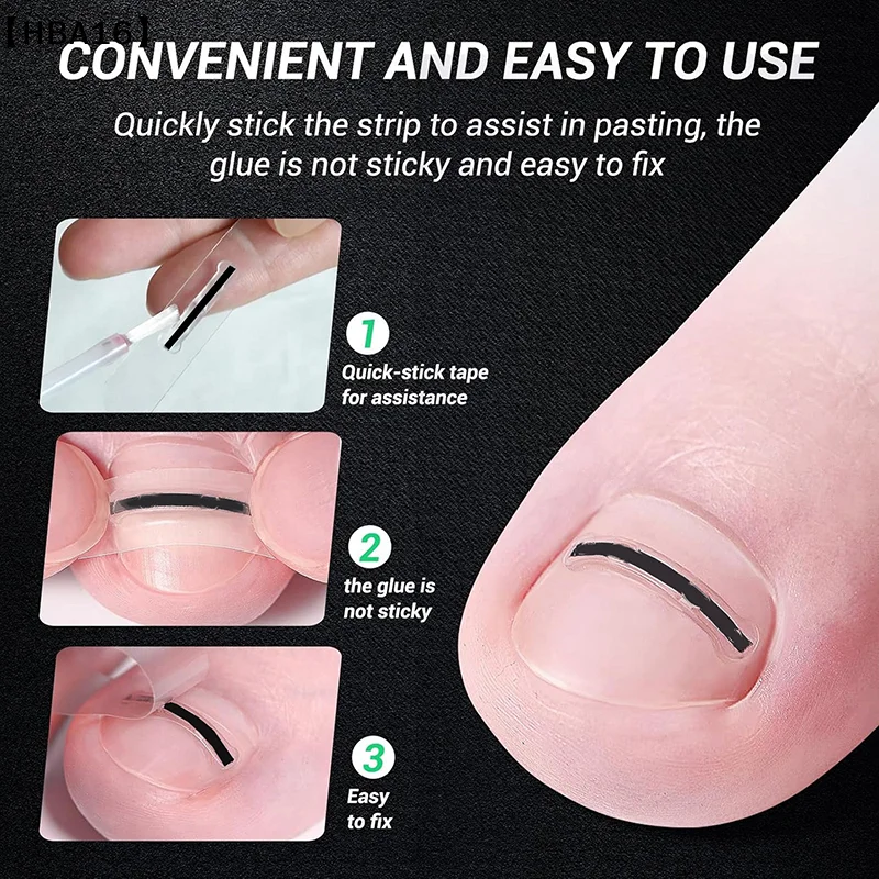 maveraHBA16 Adesivos de Correction d'ongle incarné Patchs correcteur d'ongle Invisible Patch auxiliaire haute résistance Traitement de Paronychia