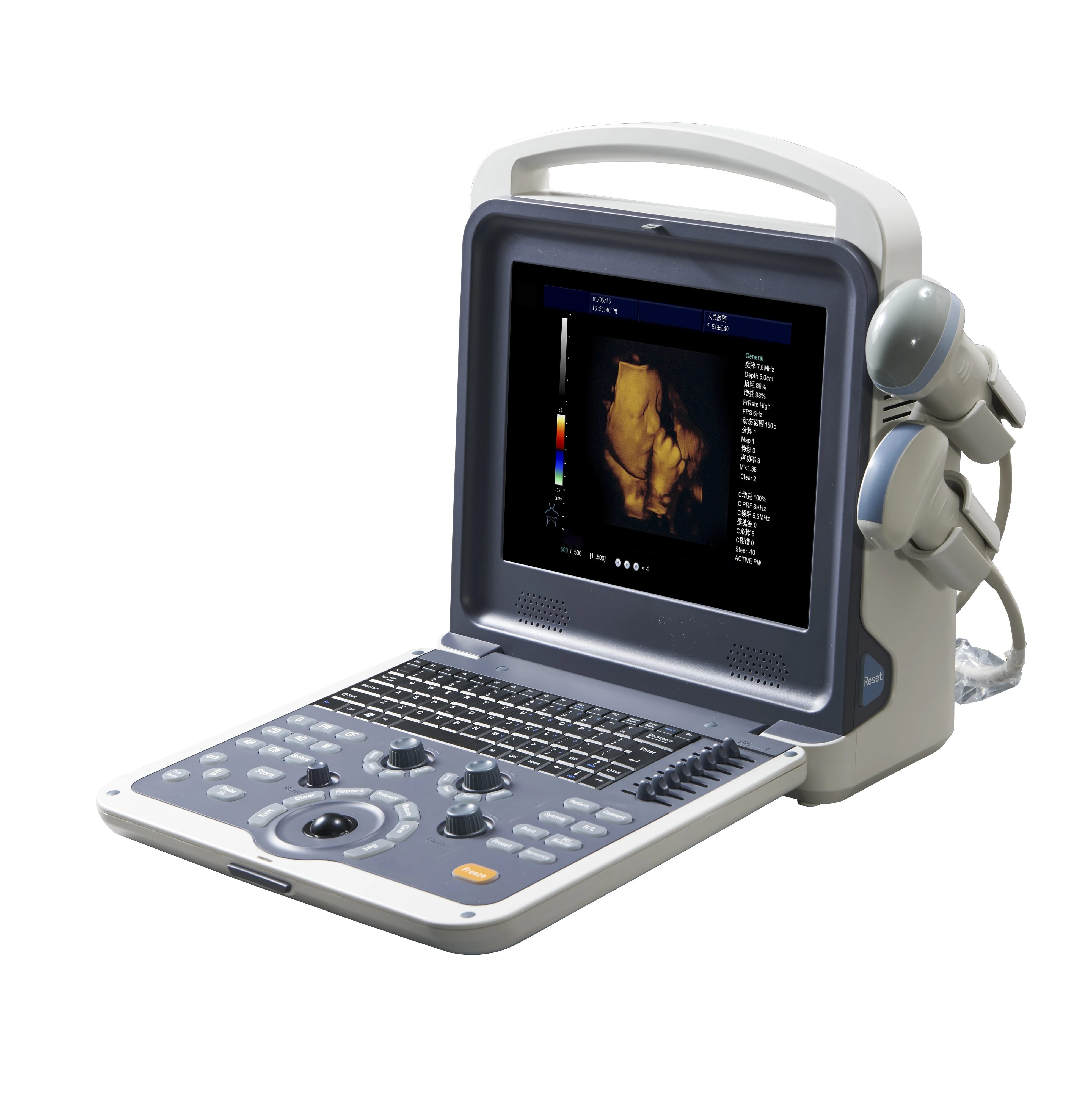 12 Inch LED Screen 2D 3D 4D Portbale Color Doppler Ultrasound Machine Diagnostic System