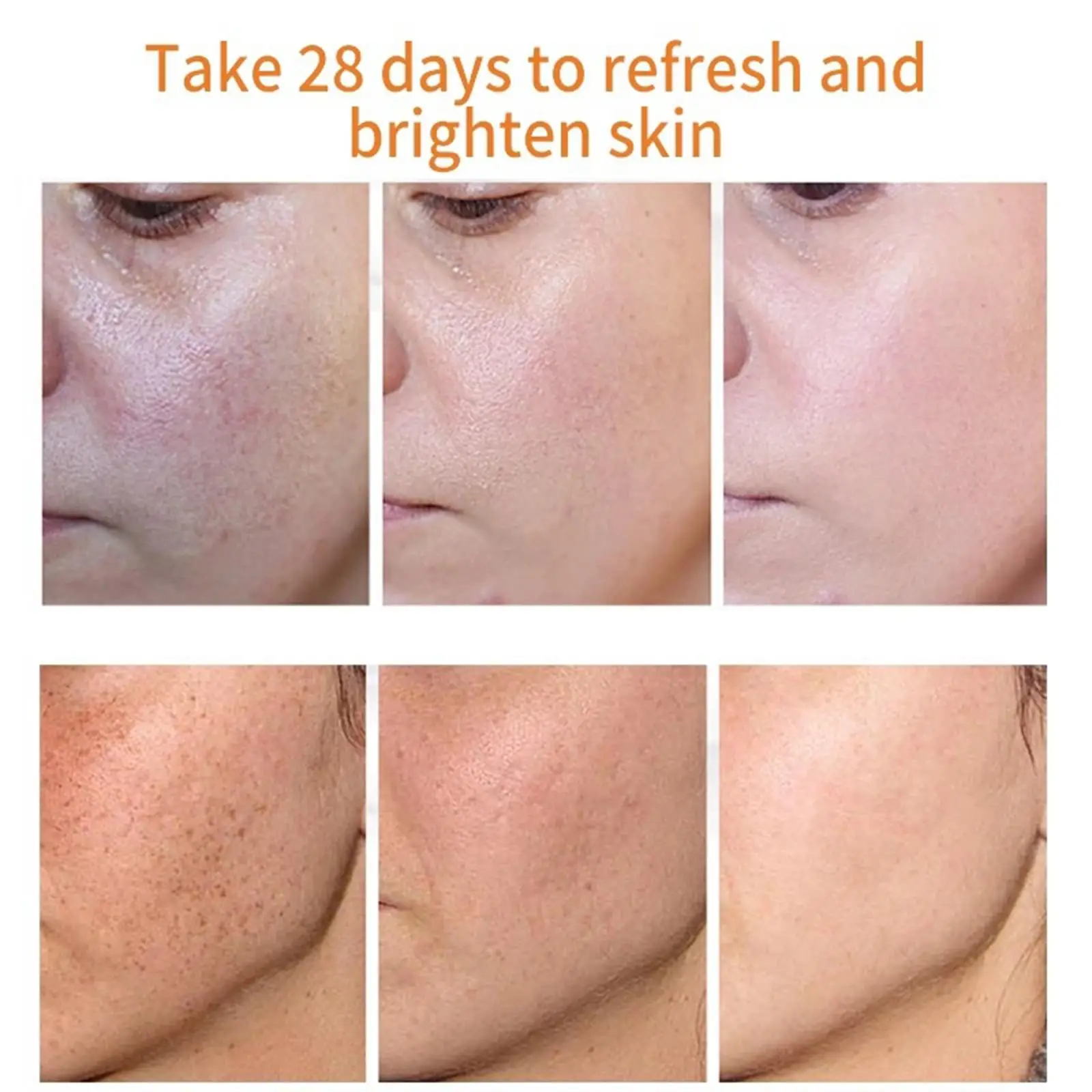 20ml Dark Spot Corrector Cream Whitening Freckle Cream for Face, Arms, Legs Highly Effective Ingredients Restores Skin Powerful