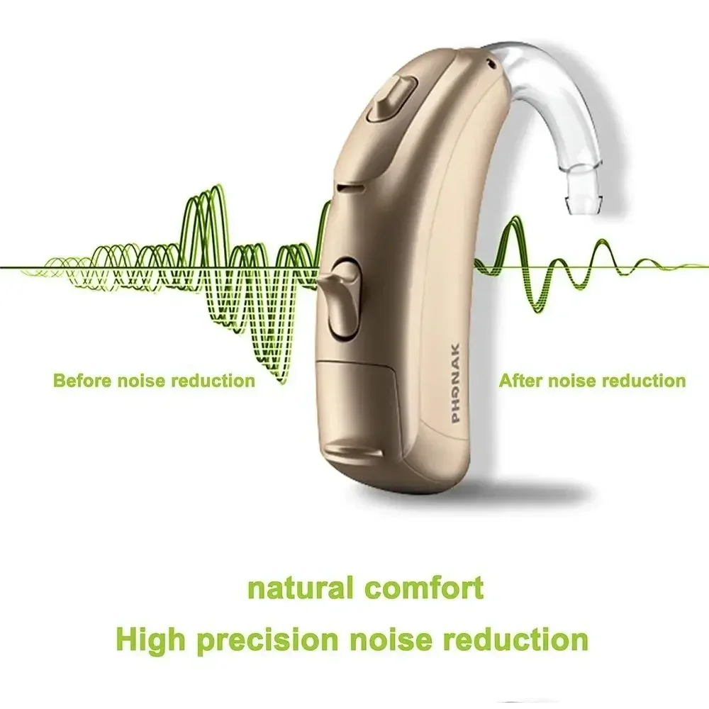 Phonak Vitus Hearing Aids Original 120dB Strong Power Hearing Aid For Severe Deafness,6 Channles Programmable Ear Care Aids