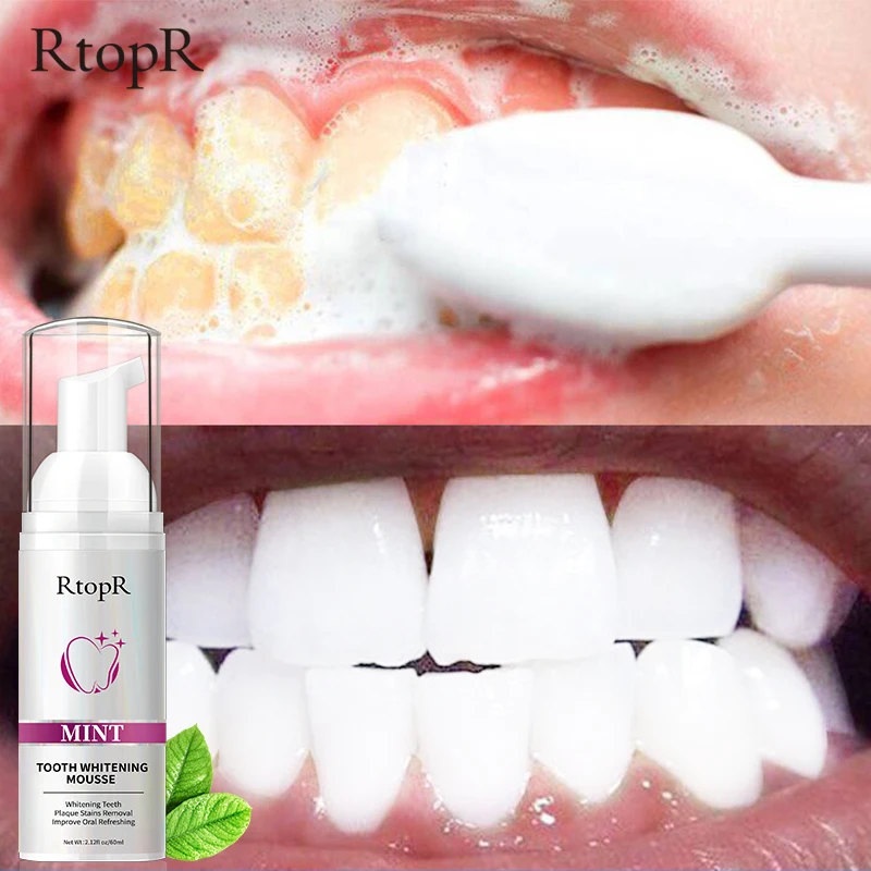 Teeth Whitening Toothpaste Remove Stains Effectively Whiten Teeth Fresh Breath Mousse Remove Stubborn Stains Oral Hygiene