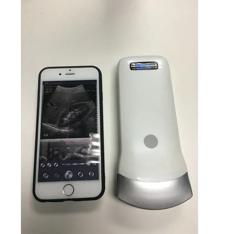 Portable B/W Ultrasound Scanner Medical Abdominal/Convex  preg nancy Ultrasound Examination Probe for Human