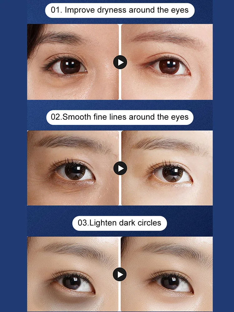 RF Oogzorgapparaat Huidlifting Verlicht vermoeidheid Massage Heet kompres Verminder donkere kringen Oogzwelling Anti-rimpel Schoonheidsoog