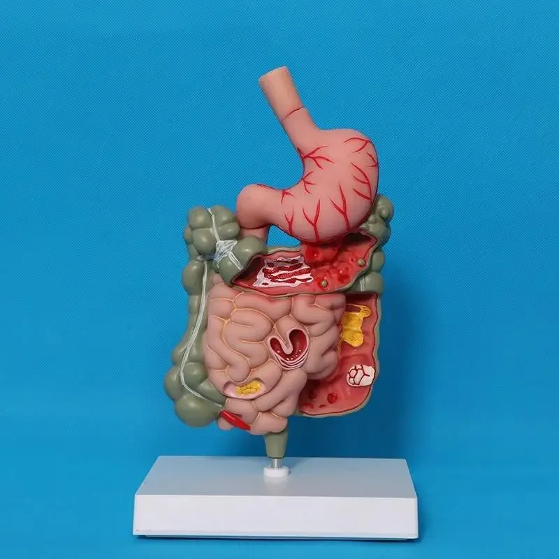 1Pc Educational Human Digestive System Model Stomach Anatomy Large Intestine Cecum Rectum Duodenum Internal Organs Display