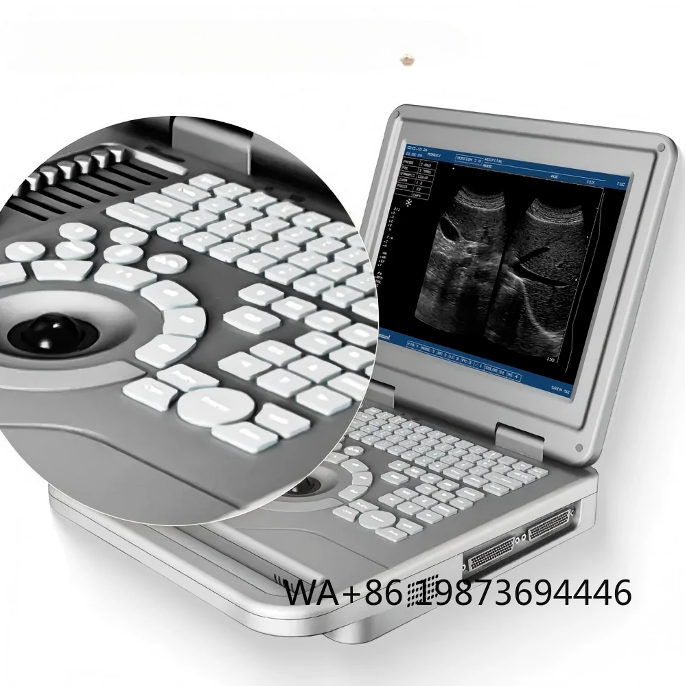 Ultrasound Scanner Portable Ultrasonic Imaging System For  Veterinary Use  Hospital Diagnostic Examination Device
