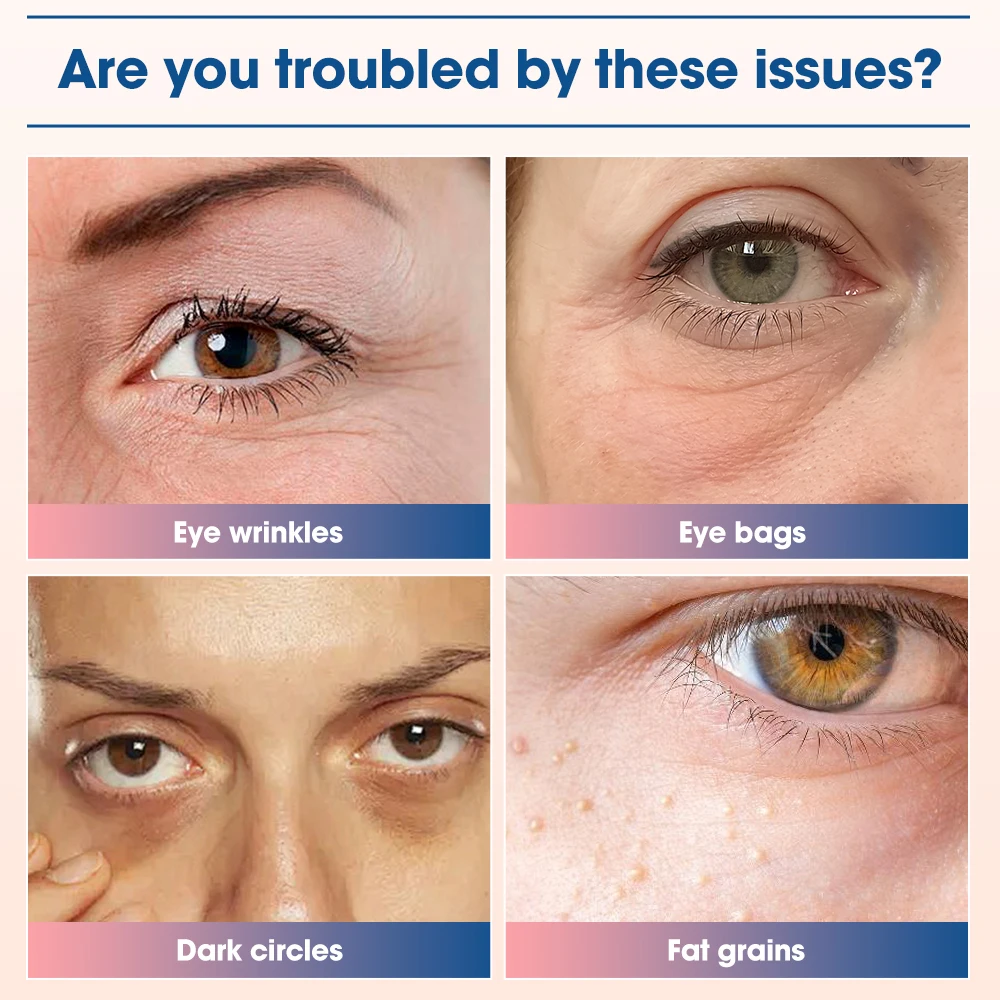 660nm Red Light Eye Massager with EMS Anti-Aging Eye Care Device Reduce Bags & Dark Circles Portable Eye Rejuvenation Pads