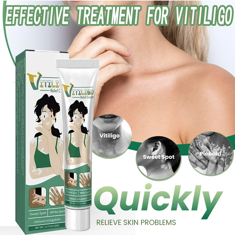 

White Spot Removal Vitiligo Cream Natural Relief Skin Treatment Effective for vitiligo Soothing Eliminate Pigment Hydrates