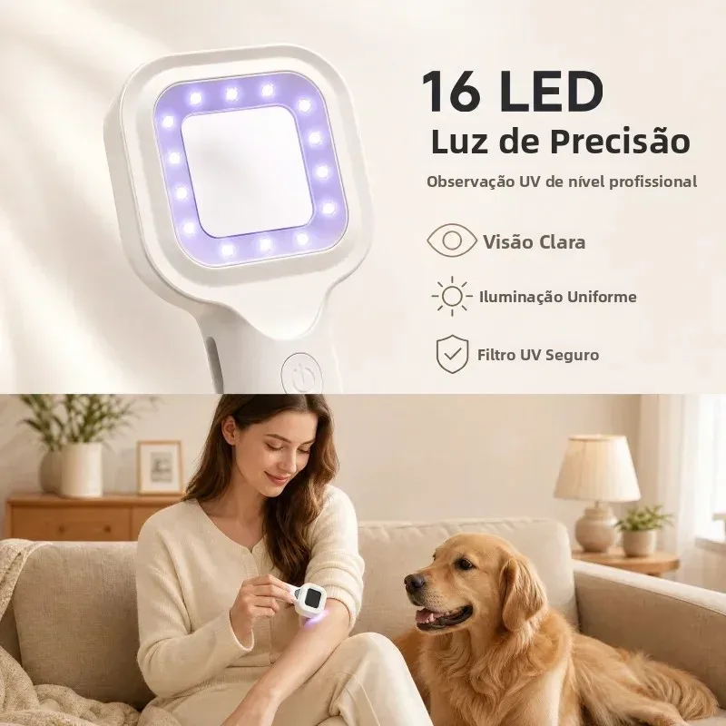 woods-lamp-skin-analyzer-ultraviolet-detection-light-vitiligo-examination-magnifier-home-use-cat-ringworm-diagnostic-lamp