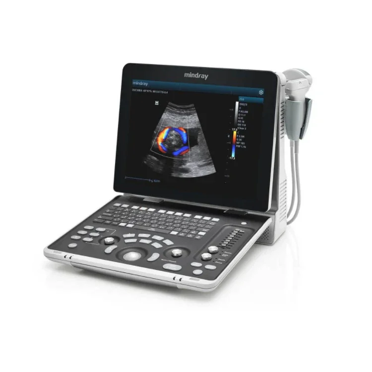 Mindray Z60 Vet Digital Ultrasound System 3D 4D Optional Portable Veterinary Color Doppler usg