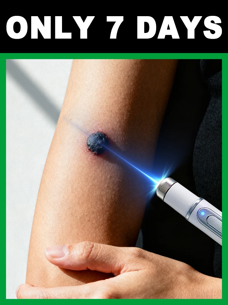 

Worried about wart infection This laser pointer ⁱˢ ˢᵘᵖᵉʳ ᵉᶠᶠᵉᶜᵗⁱᵛᵉ ᵃᵗ ʳᵉᵐᵒᵛⁱⁿᵍ ʷᵃʳᵗˢ‧