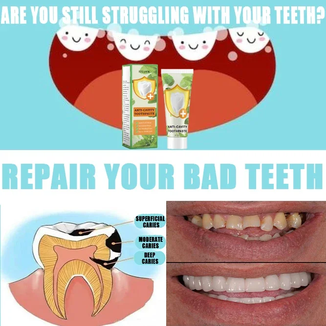 

Fast Remove Smoke Stains Toothpaste Remove Plaque Stains Oral Hygiene Cleaning Fresh Breath Teeth Whiten Tools Oral Health Care