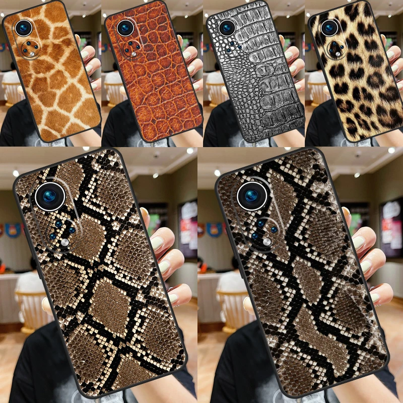 Animal Print Wildlife Fur Skin Case For Honor X9b X8b X6 X7 X8 X9 X6a X7a X8a X9a Honor 70 50 90 Lite Magic 6 5 Pro Cover