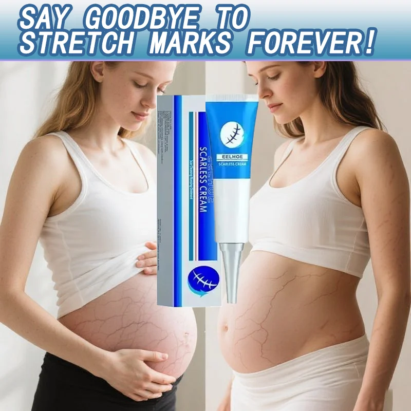 

Stretch Mark remove Cream Anti-wrinkle Anti-aging Maternal Skin Repair Remove Pregnancy Eliminate Red White Old Stretch Marks