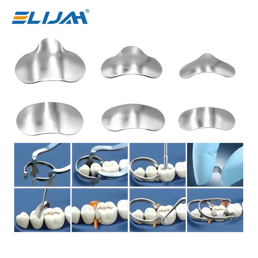 Dental Sectional Contoured Metal Matrices Matrix with Springclip No.1.330 Band Resin Clamping/Seperating Ring Dentist Tools - Image 2