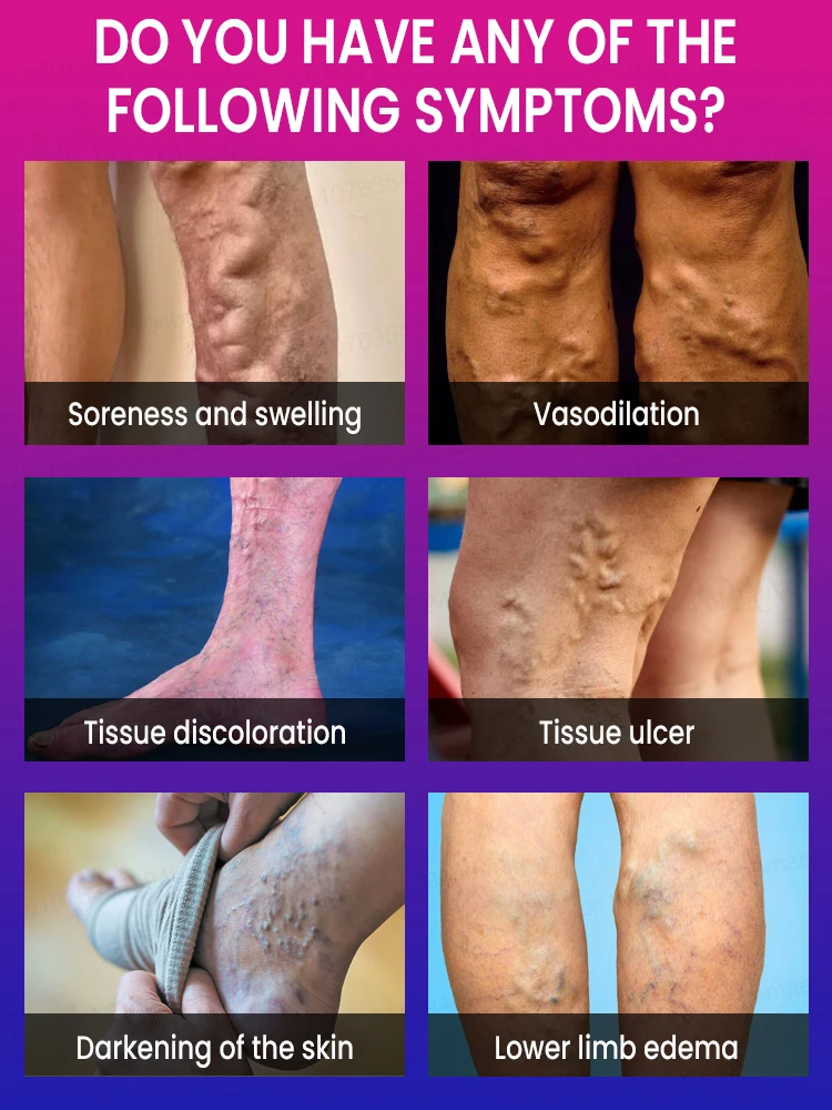 Lᴇɢ Cᴏᴍғᴏʀᴛ Dᴇᴠɪᴄᴇ - Pᴏʀᴛᴀʙʟᴇ Lᴀsᴇʀ Tʜᴇʀᴀᴘʏ ғᴏʀ Aᴄʜɪɴɢ Lᴇɢs, Hᴏᴍᴇ & Tʀᴀᴠᴇʟ Usᴇ