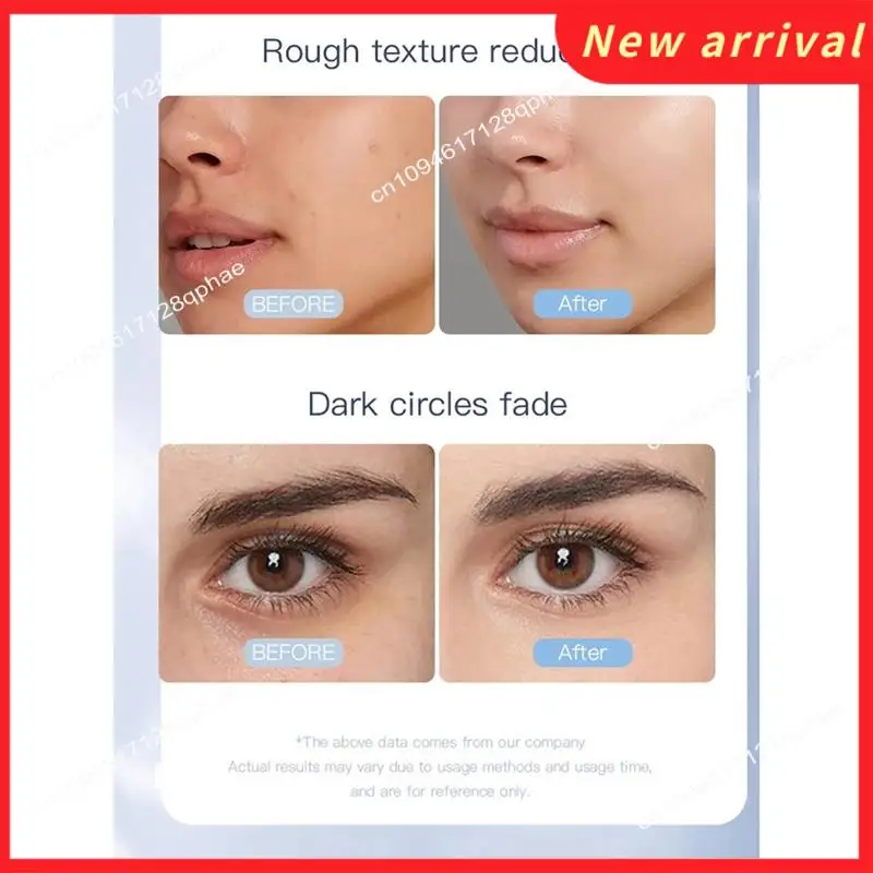 N89R Electric V-Face Lift Roller Massager EMS Microcurrent Sonic Vibration Facial Lifting Skin Tighten Massage Beauty