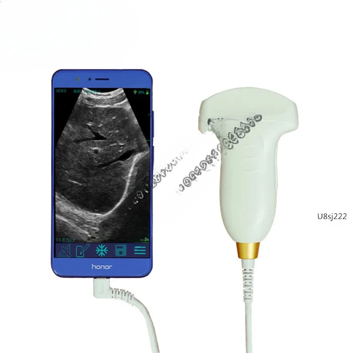 Cheapest price ecografo lineal Ultrasound probe  in cell phone and notebook