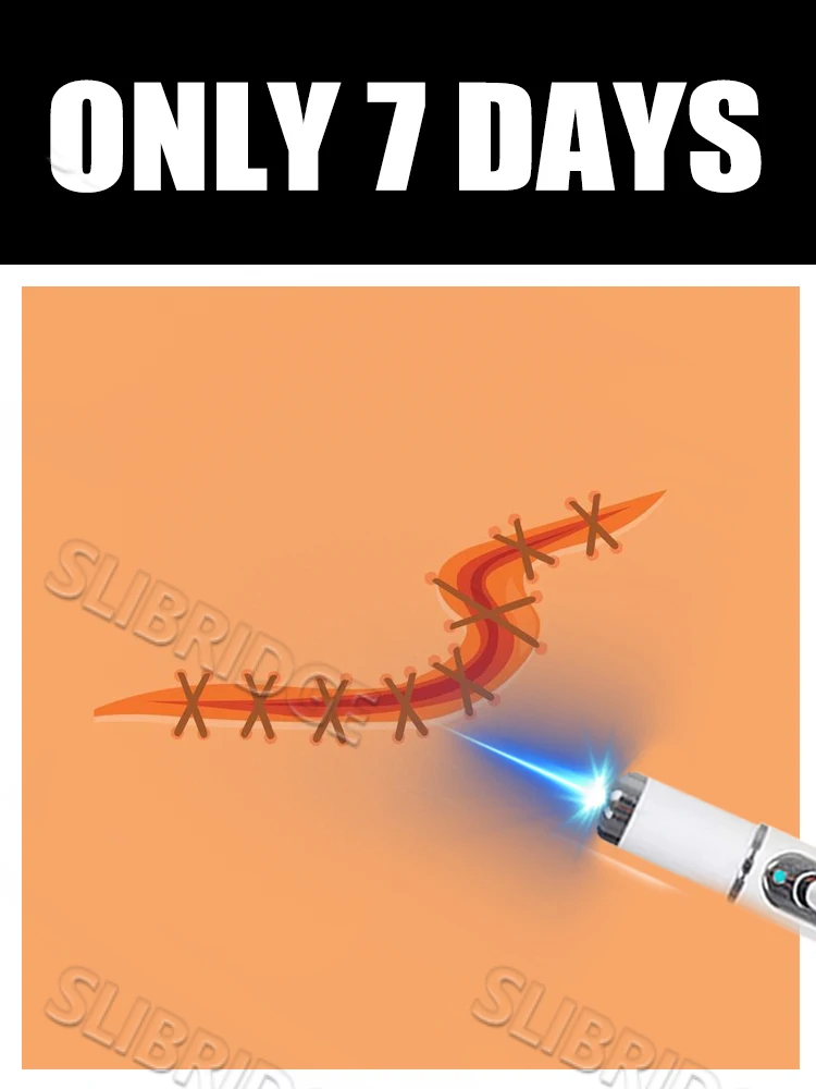 

UPGRADE Combo Set 2 blue light pen solve scar,scar care tools, unisex