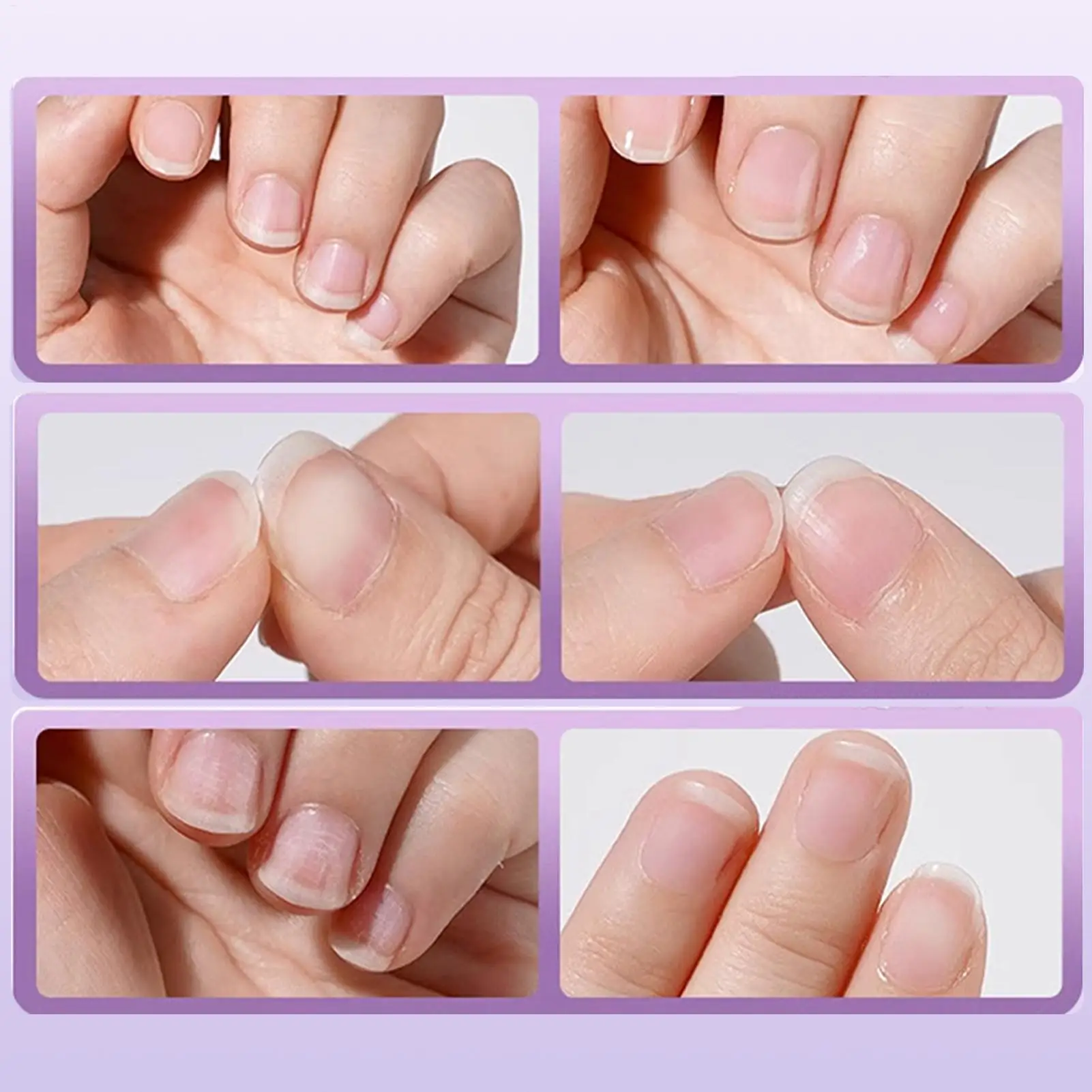 Długopis do paznokci wzmacniający, naprawiający zniszczone paznokcie, odporny na odpryski, do usuwania skórek, odżywiający, do paznokci rozdzielonych i popękanych, dla młodszych.